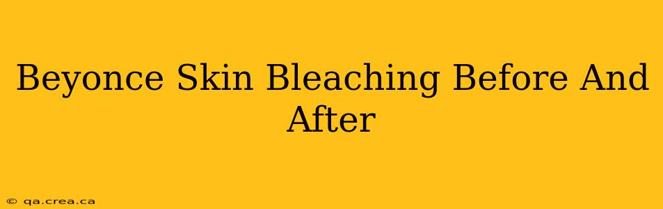 Beyonce Skin Bleaching Before And After