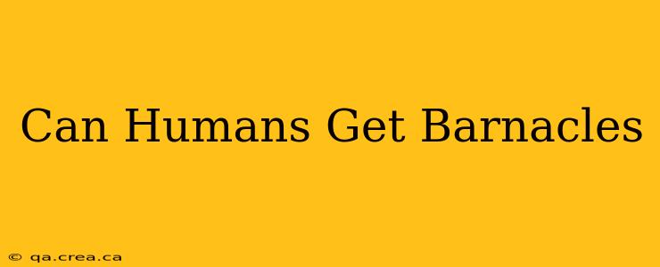 Can Humans Get Barnacles