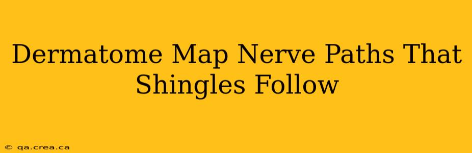 Dermatome Map Nerve Paths That Shingles Follow