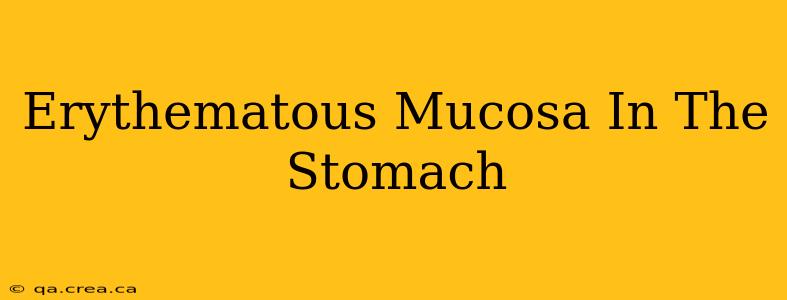 Erythematous Mucosa In The Stomach