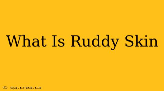 What Is Ruddy Skin